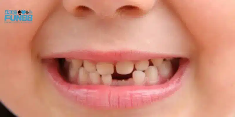 Mơ thấy rụng răng thì nên chọn số nào để trúng lớn?